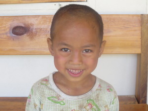 This is SoRaChi! He is love at first sight. I believe you already adore him! He is 6 years old, and suffers from chronic life threatening fungus all over his body. His parents just do not keep him clean nor do they apply the oinment so desperately needed. SoRaChi attends the school next door. He came in to me one day with 2 other boys and took off all his clothes. There he stood in front of me with those big pleading eyes. Skin all broken out from head to toe.