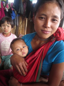 This lady's baby is one and a half years old, but it looks more like 5 months old. It has many health problems.