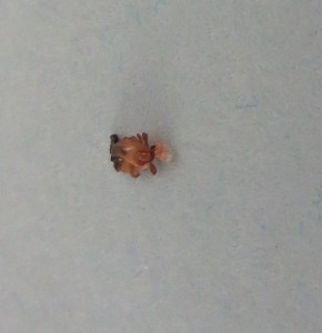 Sorry. I don't mean to gross you out, but I was so surprised that my camera could zoom in on such a TINY creature that could inflict such BIG pain!