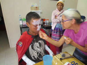 He was shocky and shivering.  His eyebrows, eyelashes and the border of his hair was burned off.  Worst of all his nasal hairs were burned off.  