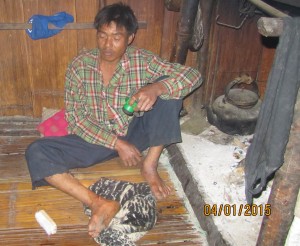 ChweeCoo with his injured ankle