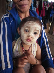 The Karen  children and young women often like to put a clay compound on their faces