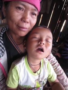 This small boy has an eye infection.  He is patiently waiting for the eye ointment to stop hurting